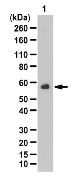 Anti-FcεRI α subunit Antibody | 06-725-I